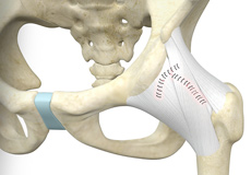 Hip Capsular Closure
