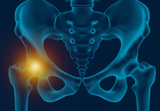 Hip Pain