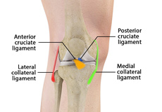 Multiligament Knee Injuries