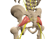 Piriformis Syndrome